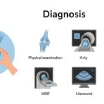 Bursiterre: Causes, Symptoms, Types, Diagnosis, Treatment & Prevention